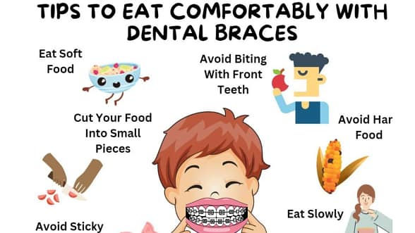 Eating with Braces Eating with Braces
