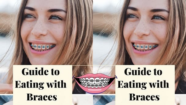 Guide to Eating with Braces Guide to Eating with Braces